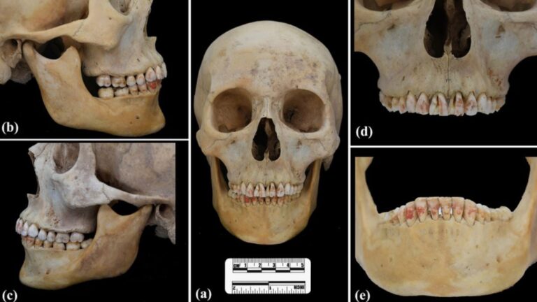 Skull 1741861740037.jpg